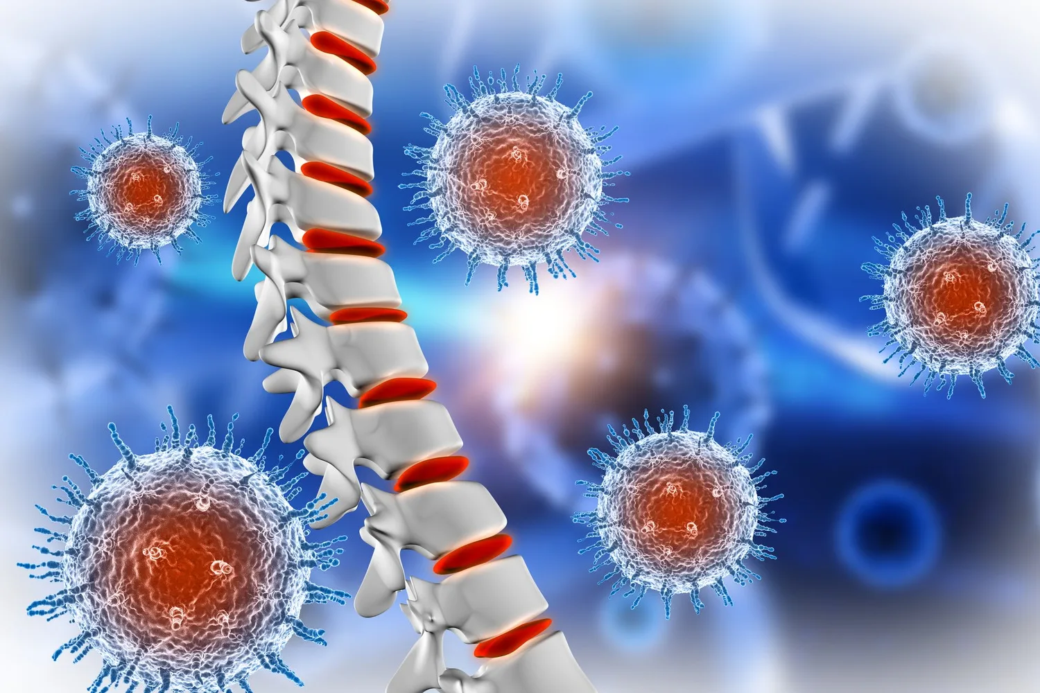Infecciones de columna en Mexicali, B.C.: Diagnóstico y Tratamiento Especializado