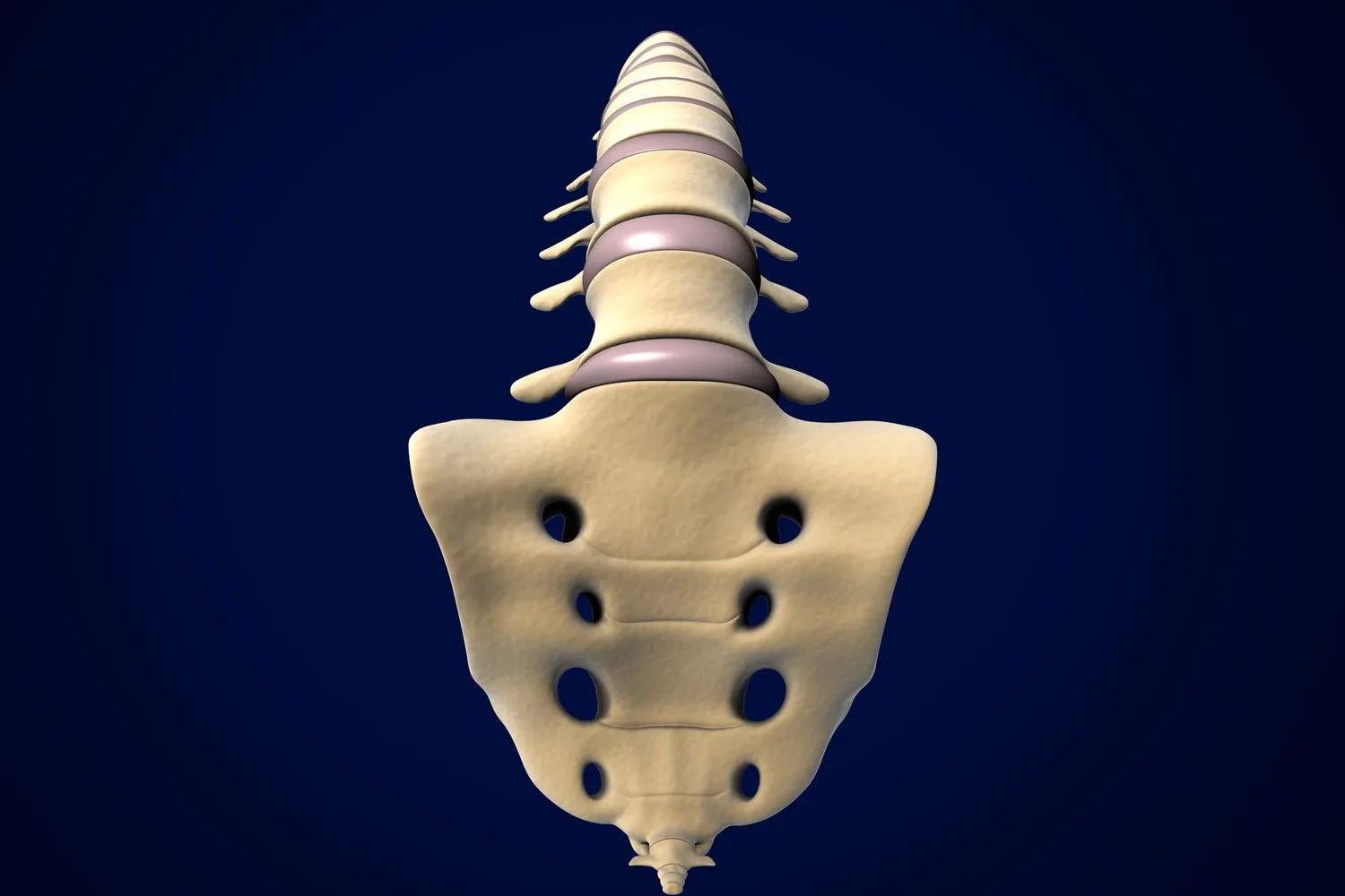 Prótesis de disco (reemplazo de disco) en Mexicali, B.C.: Solución Avanzada para el Dolor de Columna