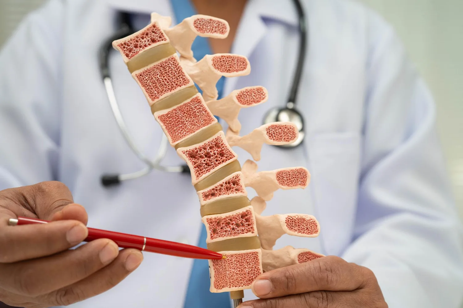 Tumor vertebral en Mexicali, B.C.: Diagnóstico y tratamiento especializado
